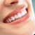 Cara Memutihkan Gigi Hanya Dalam 5 Menit